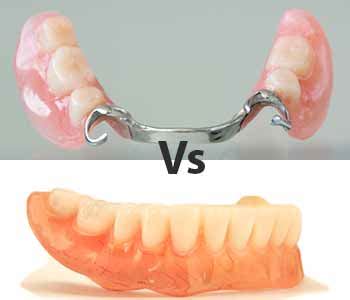 metal housing denture|plastic dentures vs acrylic.